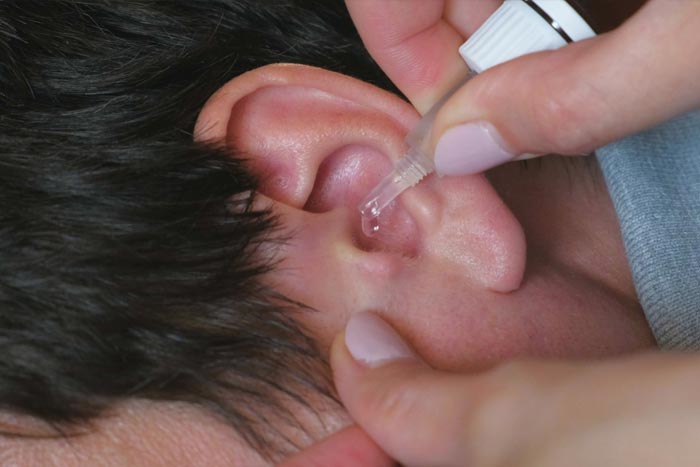 درمان گرفتگی گوش با کمک محلول